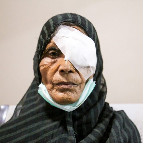 Ctaract - life transforming surgery